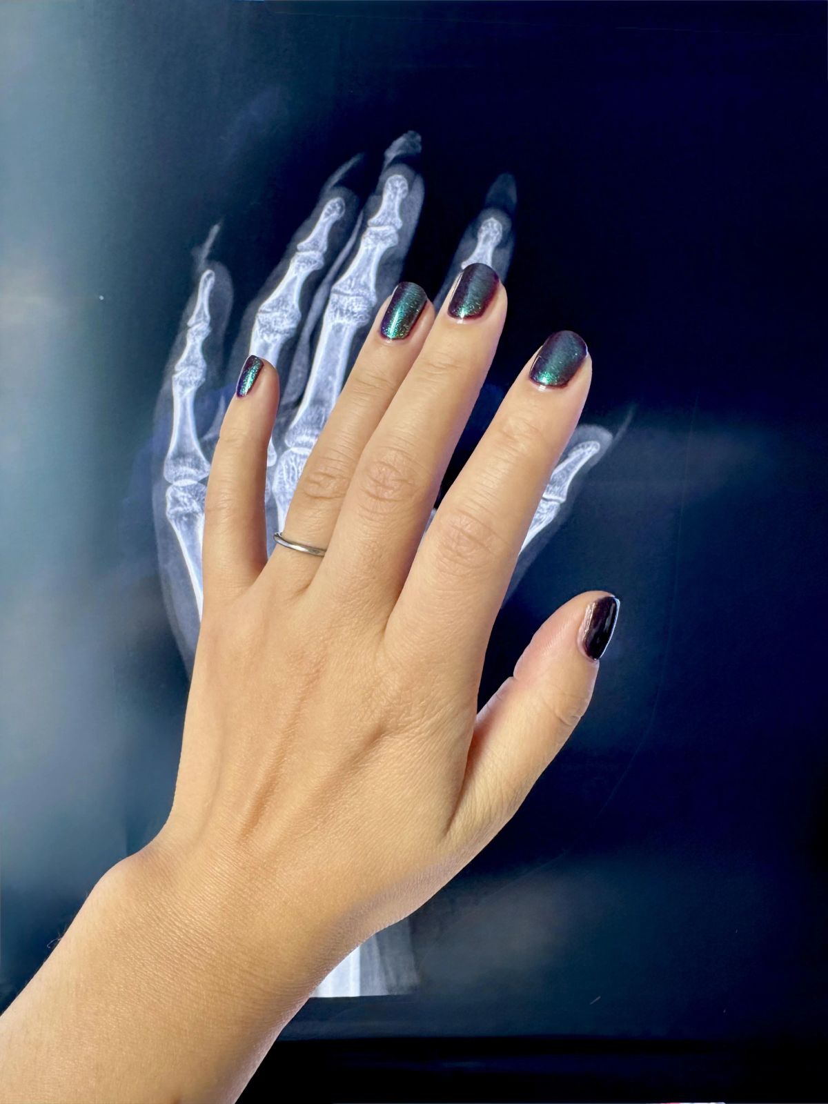 Dark Teal Shimmer Oval Nails Dark Teal Shimmer Oval Nails β Winter Nails for Teens